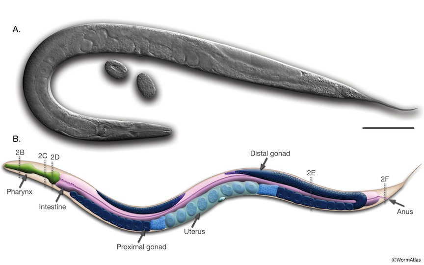 Adult herm C.elegans2.jpg