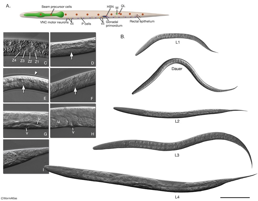 Larvae C.elegans.jpg